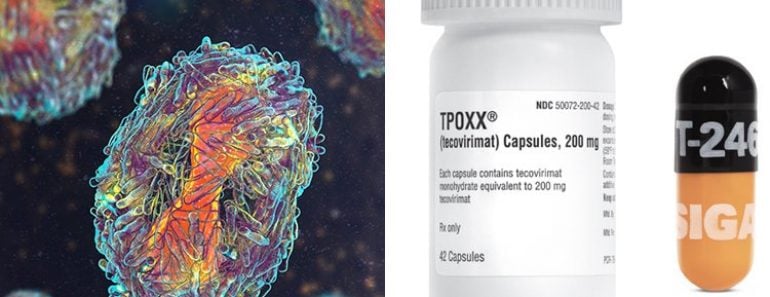 Monkeypox treatment in America
